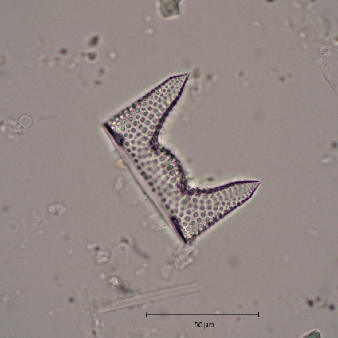 A photo of an Antarctic diatom under a microscope