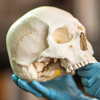 Forensic analysis of a skull